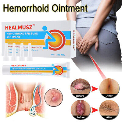 Hemorrhoid Cream Treatment Internal Piles External Anal Fissure Pain Relief-image